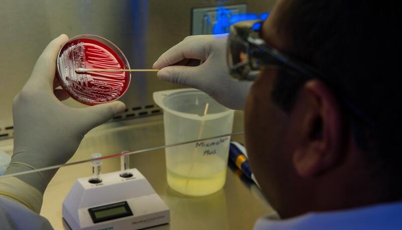 Batterio listeria, che cos’è e perché sono stati ritirati prodotti dai supermercati