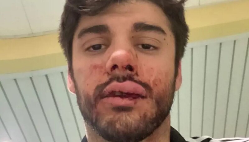Francesco picchiato dal fidanzato della ragazza che ha difeso: "Questo è il nostro Paese, questo è il mondo in cui vivo"